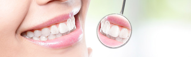 Rehabilitation oral en Polanco